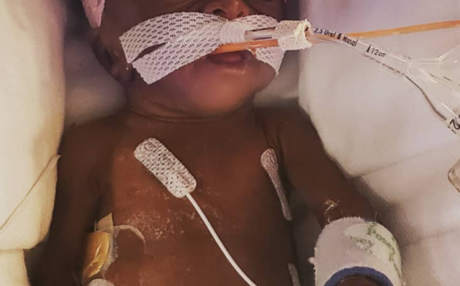 The Simple Nutritional Choice That Could Change Your Preemie’s Future 